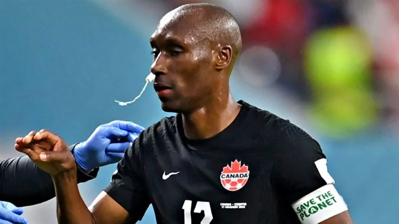 加拿大隊長哈欽森被拍到用衛生棉條來止鼻血。（圖／翻攝自FIFA官網）.jpg